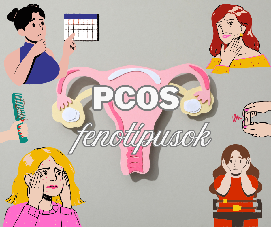 A PCOS fenotípusai, avagy nem minden PCOS egyforma